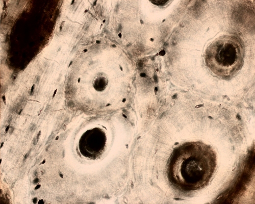 Ground section of bone