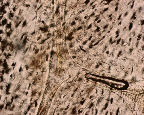 Ground section of bone