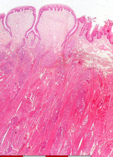 Circumvallate papilla