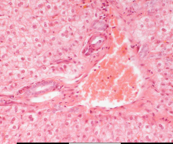 High magnification of the liver