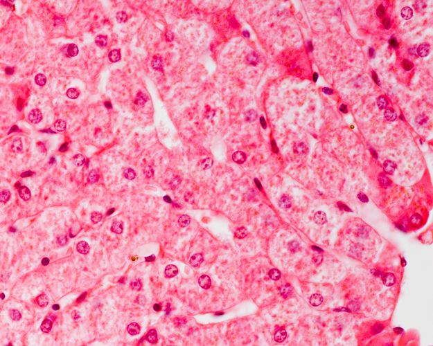 Haematoxillin stained liver