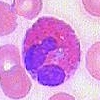 Eosinophil