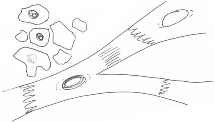 Drawing of cardiac muscle