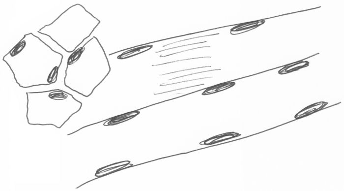Drawing of skeletal muscle